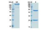 Obinutuzumab Humanized Antibody in SDS-PAGE (SDS-PAGE)