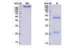 Ibalizumab Humanized Antibody in SDS-PAGE (SDS-PAGE)