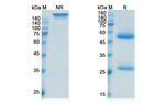 Oxelumab Antibody in SDS-PAGE (SDS-PAGE)