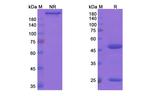 Ocaratuzumab Humanized Antibody in SDS-PAGE (SDS-PAGE)