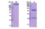 Balstilimab Antibody in SDS-PAGE (SDS-PAGE)