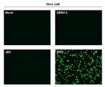 Zika Virus Envelope Protein Antibody in Immunocytochemistry (ICC/IF)