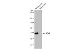 Acetylcholinesterase Antibody in Western Blot (WB)