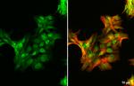 Androgen Receptor (ARv7 Splice Variant) Antibody in Immunocytochemistry (ICC/IF)