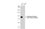 Androgen Receptor (ARv7 Splice Variant) Antibody in Western Blot (WB)