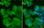 AGR2 Antibody in Immunocytochemistry (ICC/IF)