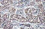 Phospho-ATM (Ser1981) Antibody in Immunohistochemistry (Paraffin) (IHC (P))