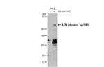 Phospho-ATM (Ser1981) Antibody in Western Blot (WB)