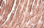 DDR2 Antibody in Immunohistochemistry (Paraffin) (IHC (P))