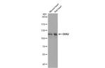 DDR2 Antibody in Western Blot (WB)