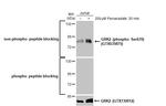 Phospho-GRK2 (Ser670) Antibody in Western Blot (WB)