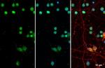 OLIG2 Antibody in Immunocytochemistry (ICC/IF)