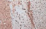 OLIG2 Antibody in Immunohistochemistry (Paraffin) (IHC (P))