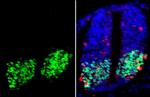 OLIG2 Antibody in Immunohistochemistry (Paraffin) (IHC (P))