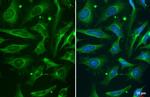 Phospho-ROCK2 (Ser1366) Antibody in Immunocytochemistry (ICC/IF)