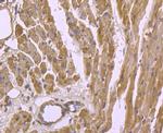 Cardiac Troponin T Antibody in Immunohistochemistry (Paraffin) (IHC (P))