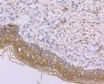 IFNAR1 Antibody in Immunohistochemistry (Paraffin) (IHC (P))