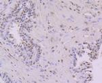 NFIB Antibody in Immunohistochemistry (Paraffin) (IHC (P))