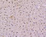 NFIB Antibody in Immunohistochemistry (Paraffin) (IHC (P))