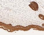 Cytokeratin 5/6 Antibody in Immunohistochemistry (Paraffin) (IHC (P))