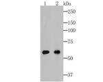 Cytokeratin 5/6 Antibody in Western Blot (WB)