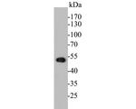 Cytokeratin 17 Antibody in Western Blot (WB)