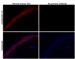 Cytokeratin 14 Antibody in Immunohistochemistry (Paraffin) (IHC (P))