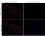 Cytokeratin 14 Antibody in Immunohistochemistry (Paraffin) (IHC (P))