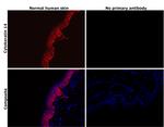 Cytokeratin 14 Antibody in Immunohistochemistry (Paraffin) (IHC (P))