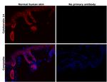 Cytokeratin 14 Antibody in Immunohistochemistry (Paraffin) (IHC (P))