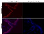 Cytokeratin 14 Antibody in Immunohistochemistry (Paraffin) (IHC (P))