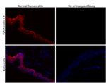 Cytokeratin 14 Antibody in Immunohistochemistry (Paraffin) (IHC (P))