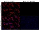 Cytokeratin 14 Antibody in Immunohistochemistry (Paraffin) (IHC (P))