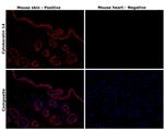 Cytokeratin 14 Antibody in Immunohistochemistry (Paraffin) (IHC (P))