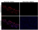 Cytokeratin 14 Antibody