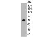 Cytokeratin 14 Antibody in Western Blot (WB)