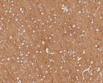 Dynamin 1 Antibody in Immunohistochemistry (Paraffin) (IHC (P))