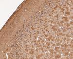 Dynamin 1 Antibody in Immunohistochemistry (Paraffin) (IHC (P))