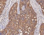 EGFR Antibody in Immunohistochemistry (Paraffin) (IHC (P))