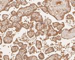 EGFR Antibody in Immunohistochemistry (Paraffin) (IHC (P))