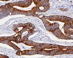 Cytokeratin 20 Antibody in Immunohistochemistry (Paraffin) (IHC (P))