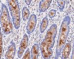 MUC5AC Antibody in Immunohistochemistry (Paraffin) (IHC (P))