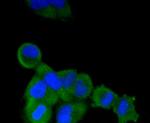 ALPL Antibody in Immunocytochemistry (ICC/IF)