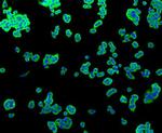 ALPL Antibody in Immunocytochemistry (ICC/IF)