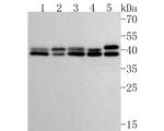 ERK1/ERK2 Antibody in Western Blot (WB)