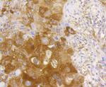 NFkB p65 Antibody in Immunohistochemistry (Paraffin) (IHC (P))