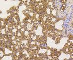 NFkB p65 Antibody in Immunohistochemistry (Paraffin) (IHC (P))