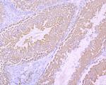 Survivin Antibody in Immunohistochemistry (Paraffin) (IHC (P))