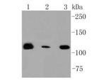 RNF20 Antibody in Western Blot (WB)