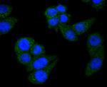 STAT6 Antibody in Immunocytochemistry (ICC/IF)